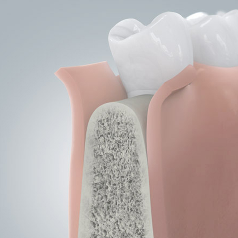 Zahn Implantat Rottal-Inn